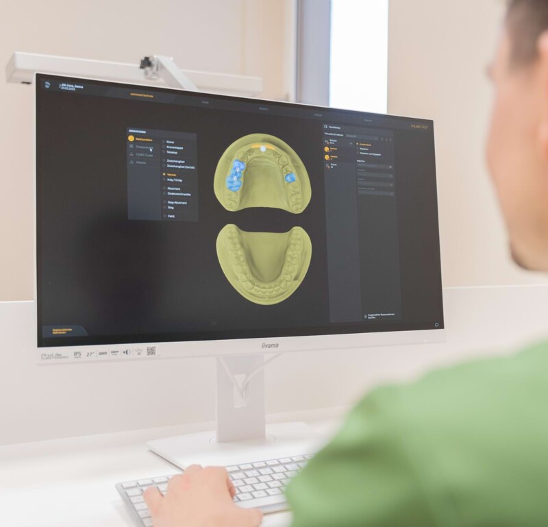 Fotoaufnahme: Christopher Schwenn schaut sich am Computer das Modell eines Gebisses an
